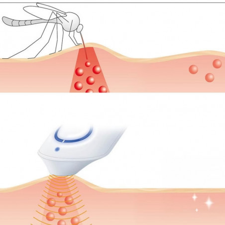 Beurer BR10 dispozitiv de tratare a mușcăturilor de țânțari, Potrivit pentru femei însărcinate și copii, 300 de aplicații, Fără substanțe chimice, Aplicare locală, Alb