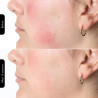 Mască fototerapeutică pentru față Silk'n LED Face Mask 100 FLM100PE1001, autonomie de 130 de minute, 4 moduri, sesiune de 10 minute, design flexibil, alb